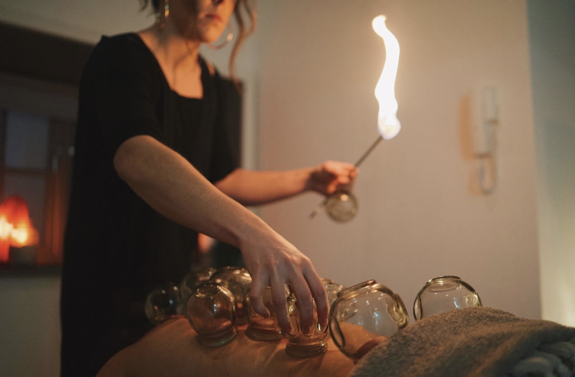 Katie holding a lit taper while placing fire cupping glasses